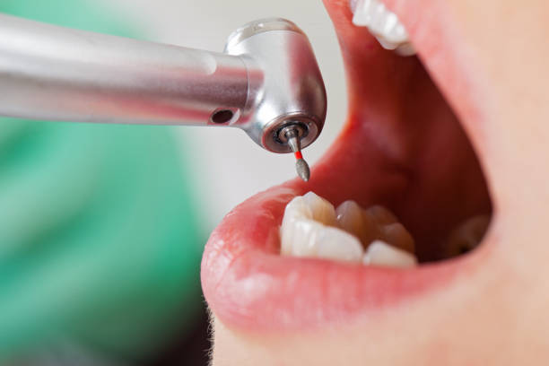 Best Emergency Dental Care for Abscessed Tooth in Tishomingo, OK